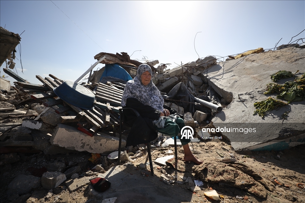 Лишившаяся ноги из-за израильских ударов палестинка нуждается в лечении за рубежом