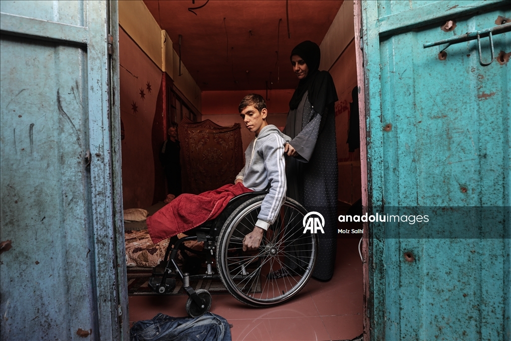 غزة.. لغم إسرائيلي أفقد الشاب داود ساقيه وسلبه أحلامه 