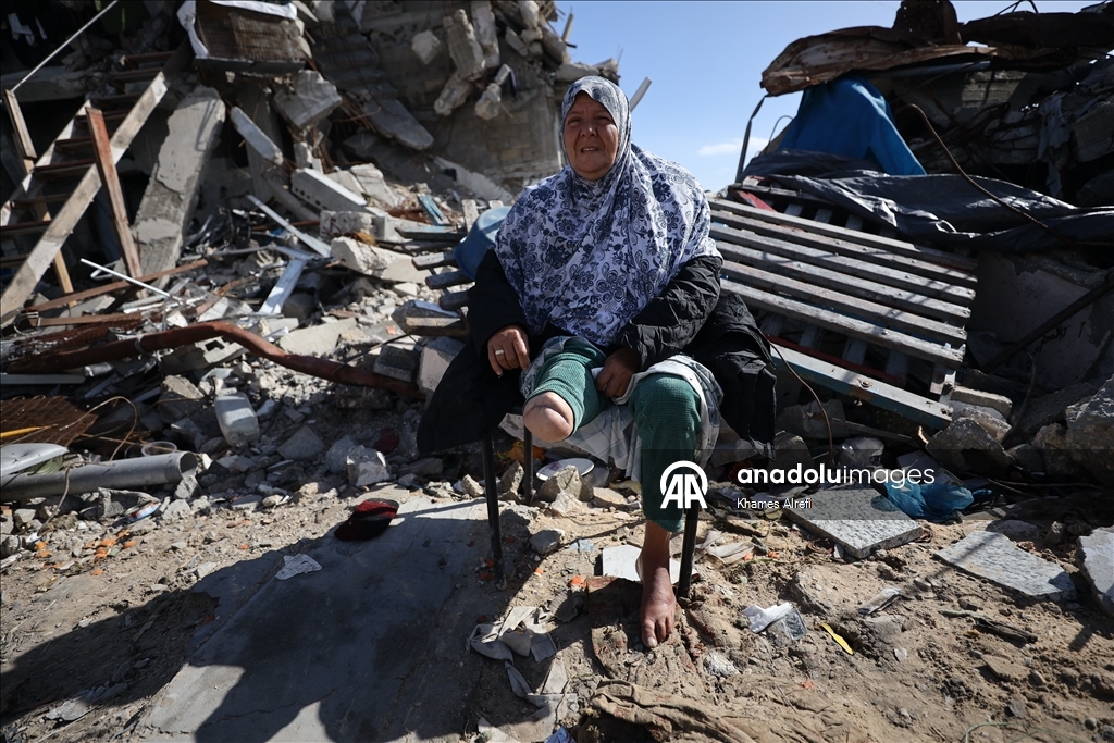 İsrail saldırılarında bir bacağını kaybeden Filistinli Nebile, tedavi olmayı bekliyor