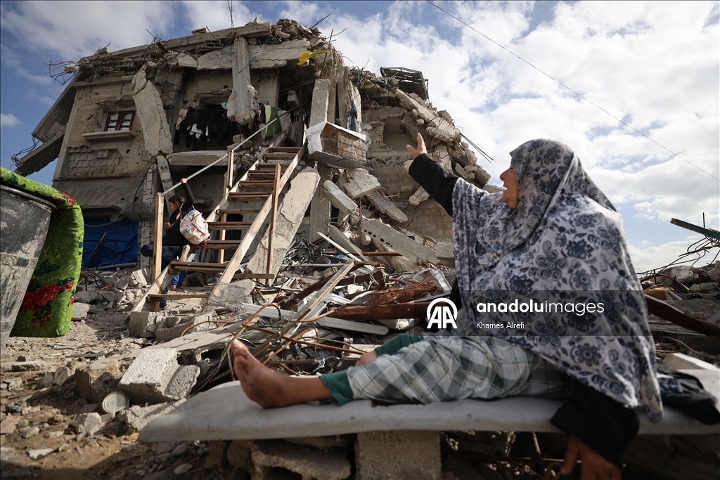 Лишившаяся ноги из-за израильских ударов палестинка нуждается в лечении за рубежом