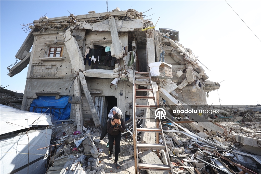 Лишившаяся ноги из-за израильских ударов палестинка нуждается в лечении за рубежом