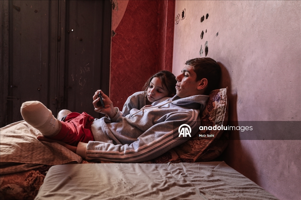 غزة.. لغم إسرائيلي أفقد الشاب داود ساقيه وسلبه أحلامه 