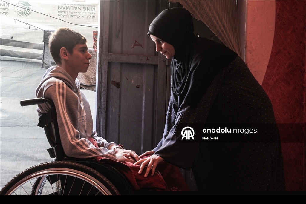 غزة.. لغم إسرائيلي أفقد الشاب داود ساقيه وسلبه أحلامه 