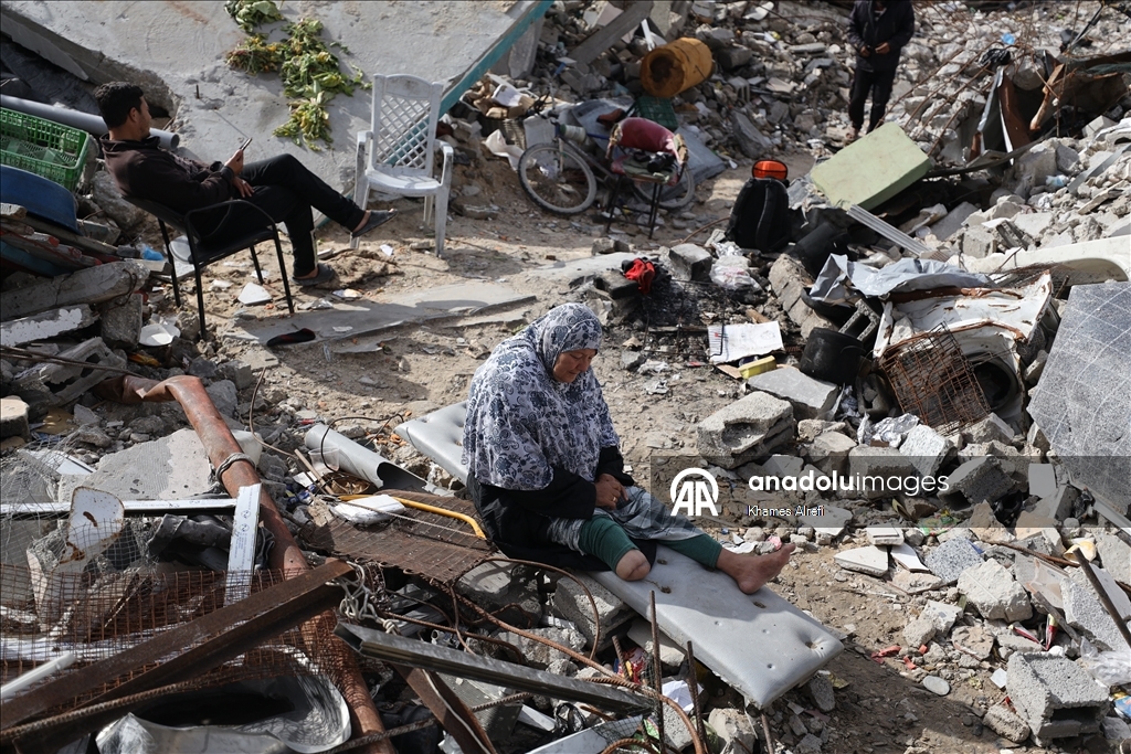 Лишившаяся ноги из-за израильских ударов палестинка нуждается в лечении за рубежом