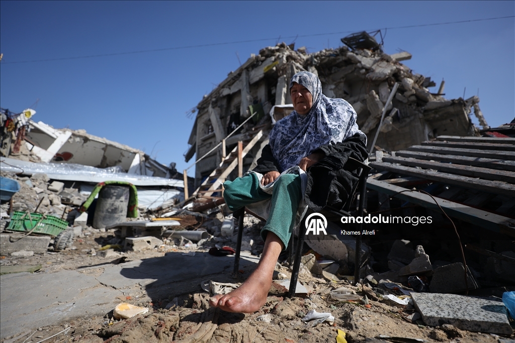 Лишившаяся ноги из-за израильских ударов палестинка нуждается в лечении за рубежом