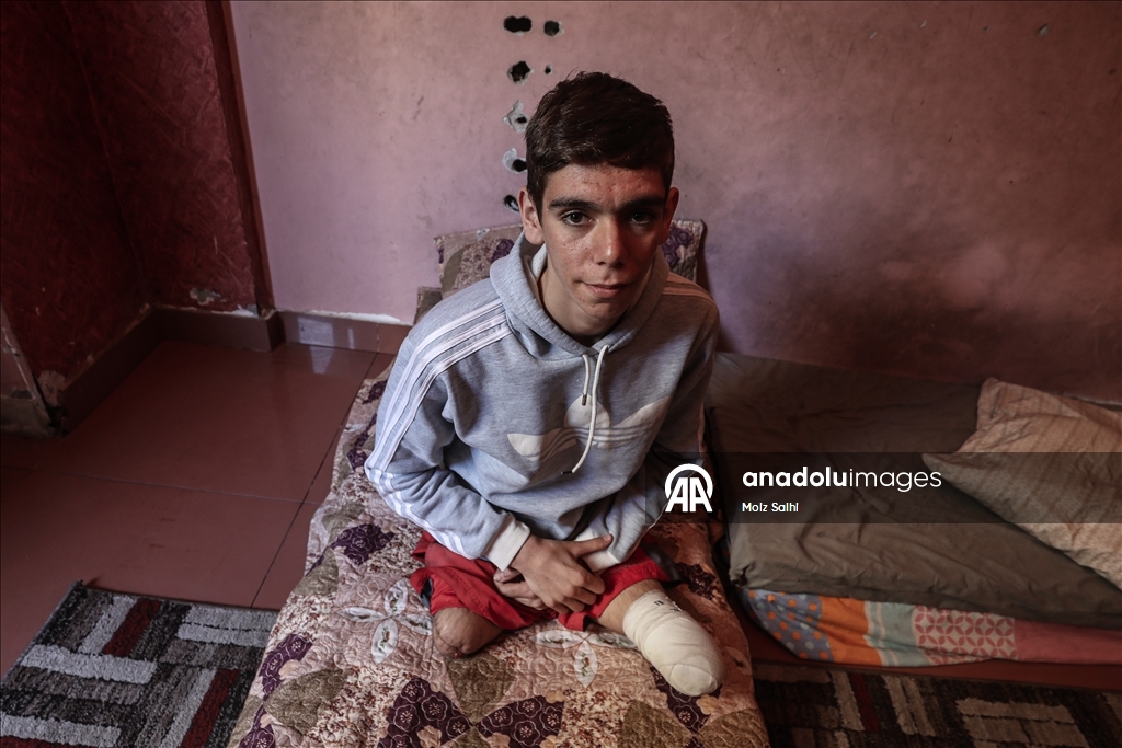 غزة.. لغم إسرائيلي أفقد الشاب داود ساقيه وسلبه أحلامه 