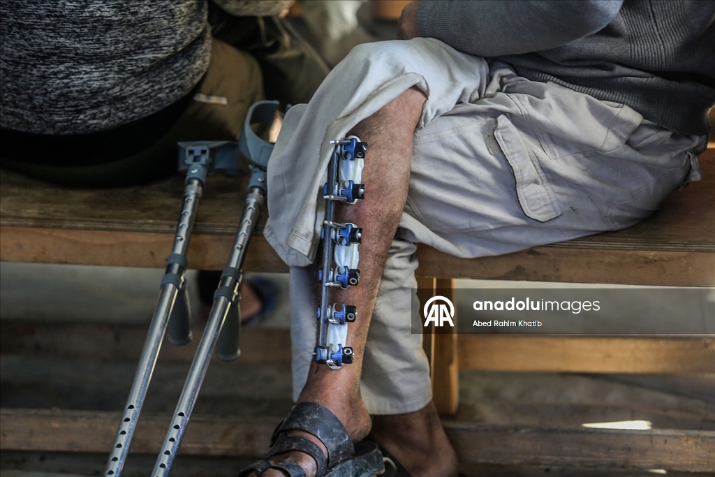 Nasır Hastanesi’nde hastalar kısıtlı imkanlarla tedavi görüyor