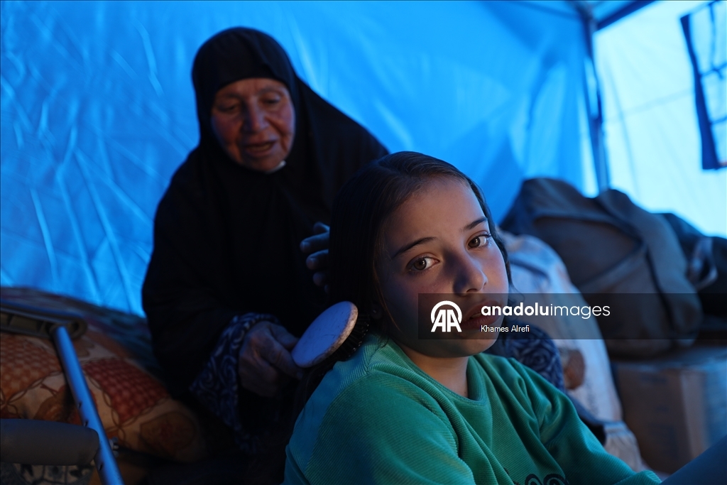 İsrail saldırısında bacağını ve ailesini kaybeden Filistinli çocuk, yaşama tutunmaya çalışıyor