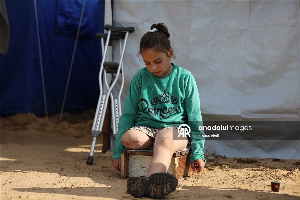 Палестинская девочка, потерявшая ногу и семью в результате израильского удара, пытается выжить