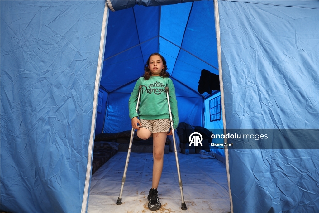 Палестинская девочка, потерявшая ногу и семью в результате израильского удара, пытается выжить