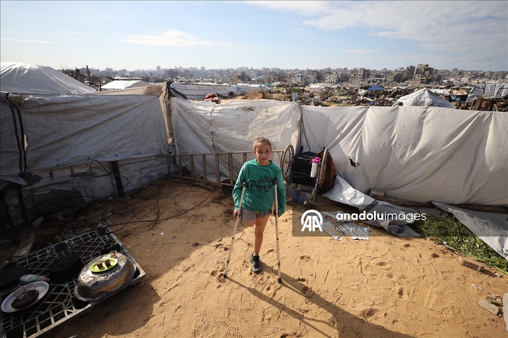 İsrail saldırısında bacağını ve ailesini kaybeden Filistinli çocuk, yaşama tutunmaya çalışıyor