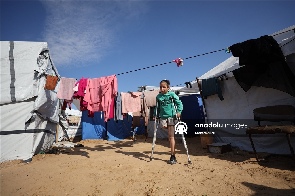 Палестинская девочка, потерявшая ногу и семью в результате израильского удара, пытается выжить