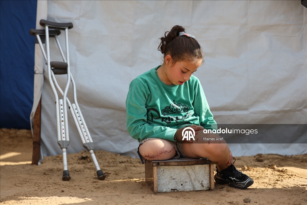 İsrail saldırısında bacağını ve ailesini kaybeden Filistinli çocuk, yaşama tutunmaya çalışıyor