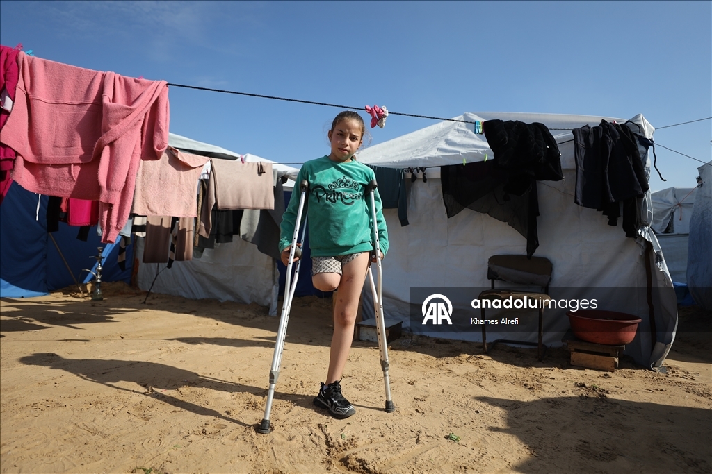 İsrail saldırısında bacağını ve ailesini kaybeden Filistinli çocuk, yaşama tutunmaya çalışıyor