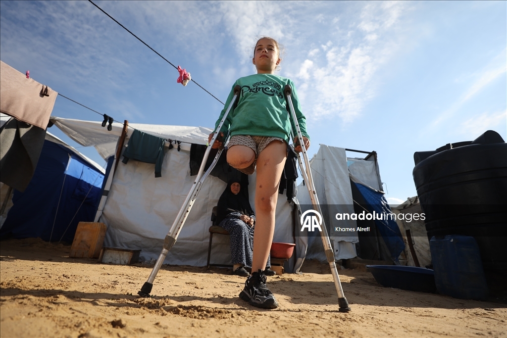 Палестинская девочка, потерявшая ногу и семью в результате израильского удара, пытается выжить