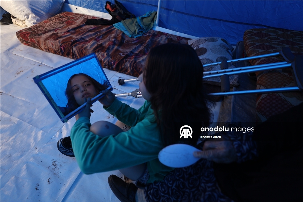 Палестинская девочка, потерявшая ногу и семью в результате израильского удара, пытается выжить