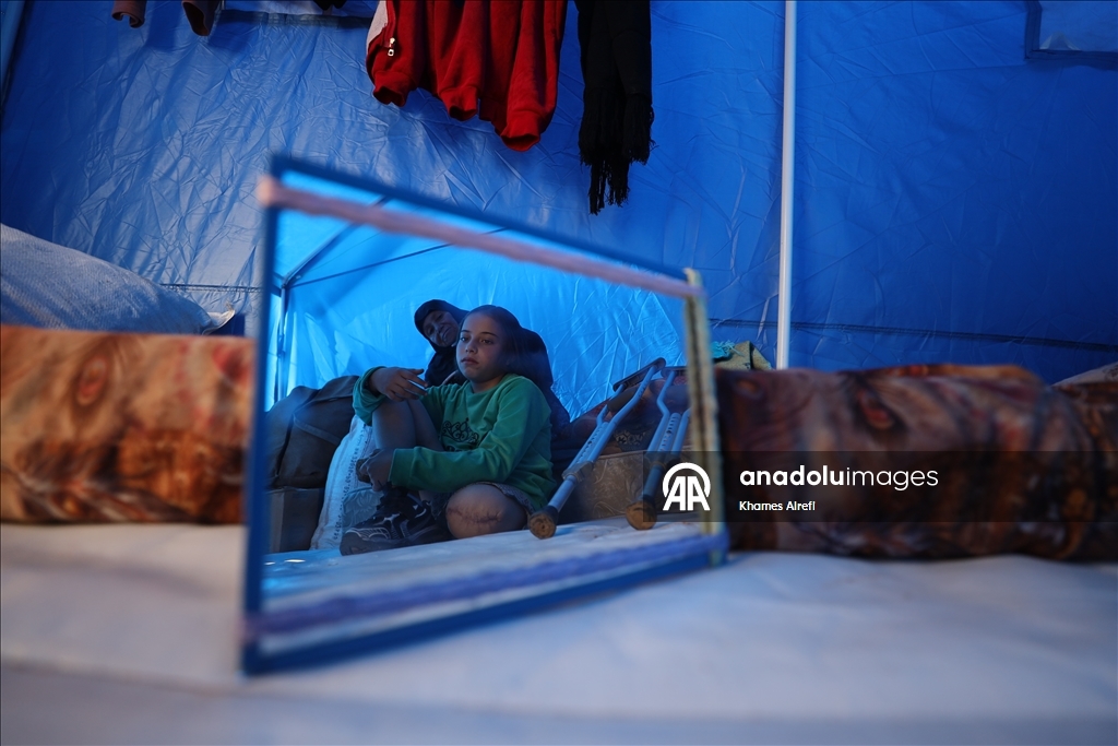 Палестинская девочка, потерявшая ногу и семью в результате израильского удара, пытается выжить