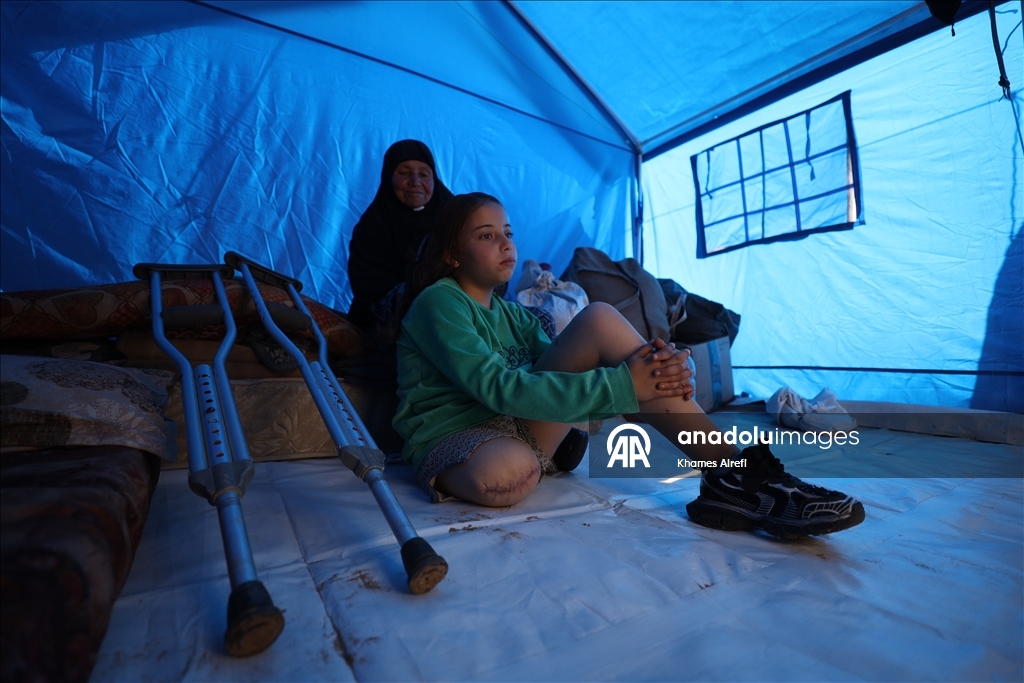 Палестинская девочка, потерявшая ногу и семью в результате израильского удара, пытается выжить