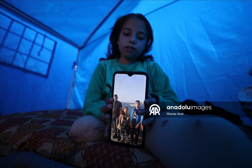 İsrail saldırısında bacağını ve ailesini kaybeden Filistinli çocuk, yaşama tutunmaya çalışıyor