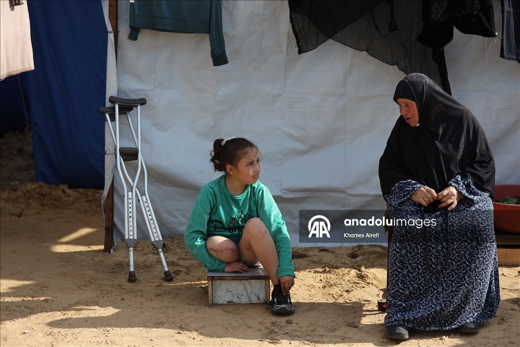 Палестинская девочка, потерявшая ногу и семью в результате израильского удара, пытается выжить