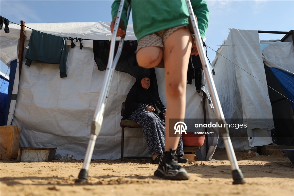 Палестинская девочка, потерявшая ногу и семью в результате израильского удара, пытается выжить
