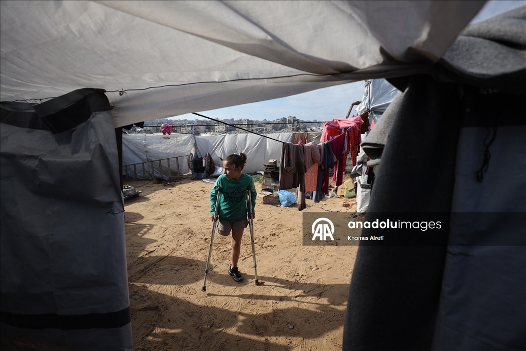 Палестинская девочка, потерявшая ногу и семью в результате израильского удара, пытается выжить