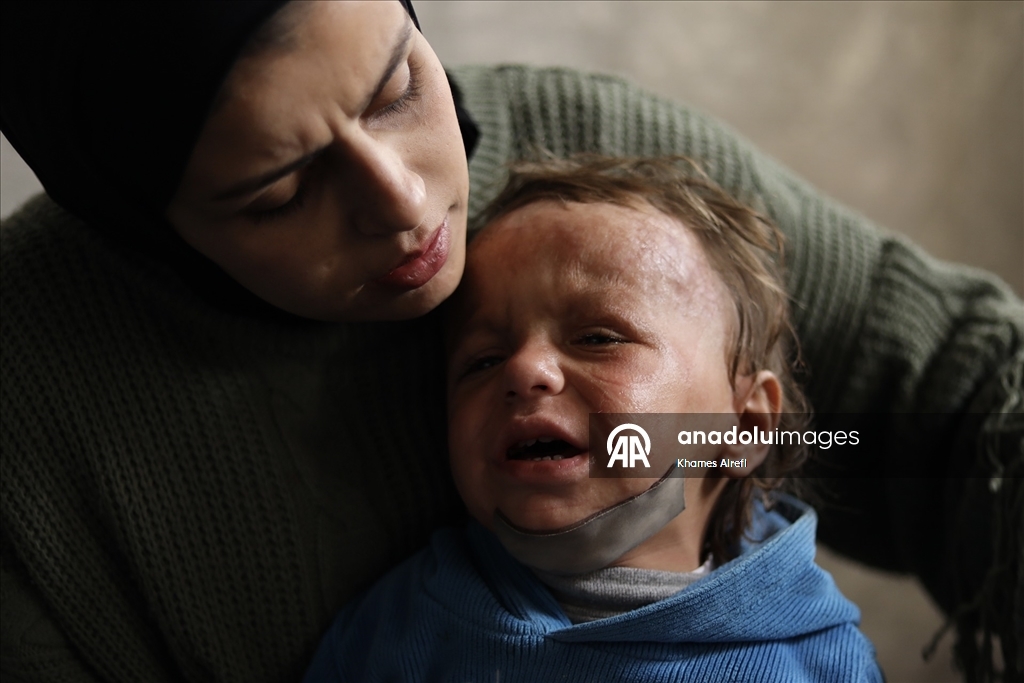 İsrail'in Gazze'ye saldırılarında ağır yaralanan Filistinli çocuk, gerekli tedaviye kavuşmayı bekliyor