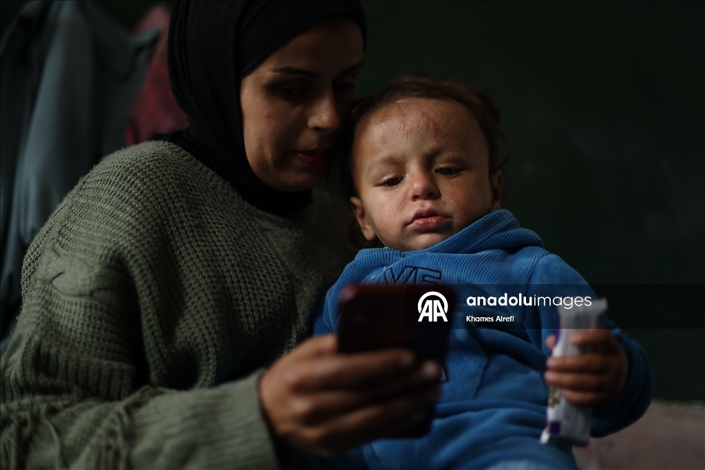 Полуторогодовалый палестинец с тяжелыми ожогами нуждается в срочном лечении после израильского удара по Газе