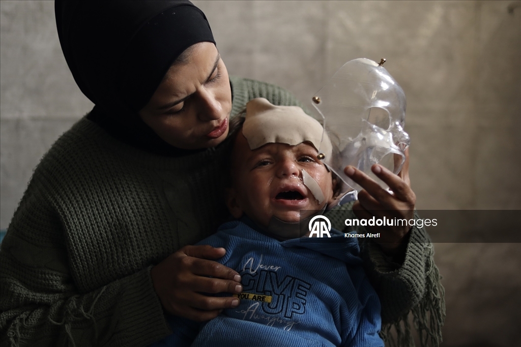 İsrail'in Gazze'ye saldırılarında ağır yaralanan Filistinli çocuk, gerekli tedaviye kavuşmayı bekliyor