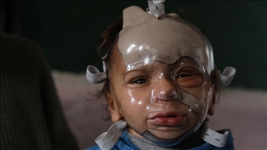 İsrail'in Gazze'ye saldırılarında ağır yaralanan Filistinli çocuk, gerekli tedaviye kavuşmayı bekliyor