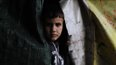 İsrail saldırısında gözlerini kaybeden Filistinli çocuk hayatta kalma mücadelesi veriyor