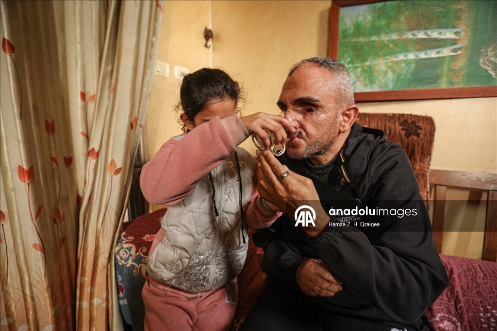 الفلسطيني أحمد.. مأساة فقد الابن وألوان الحياة بقصف إسرائيلي