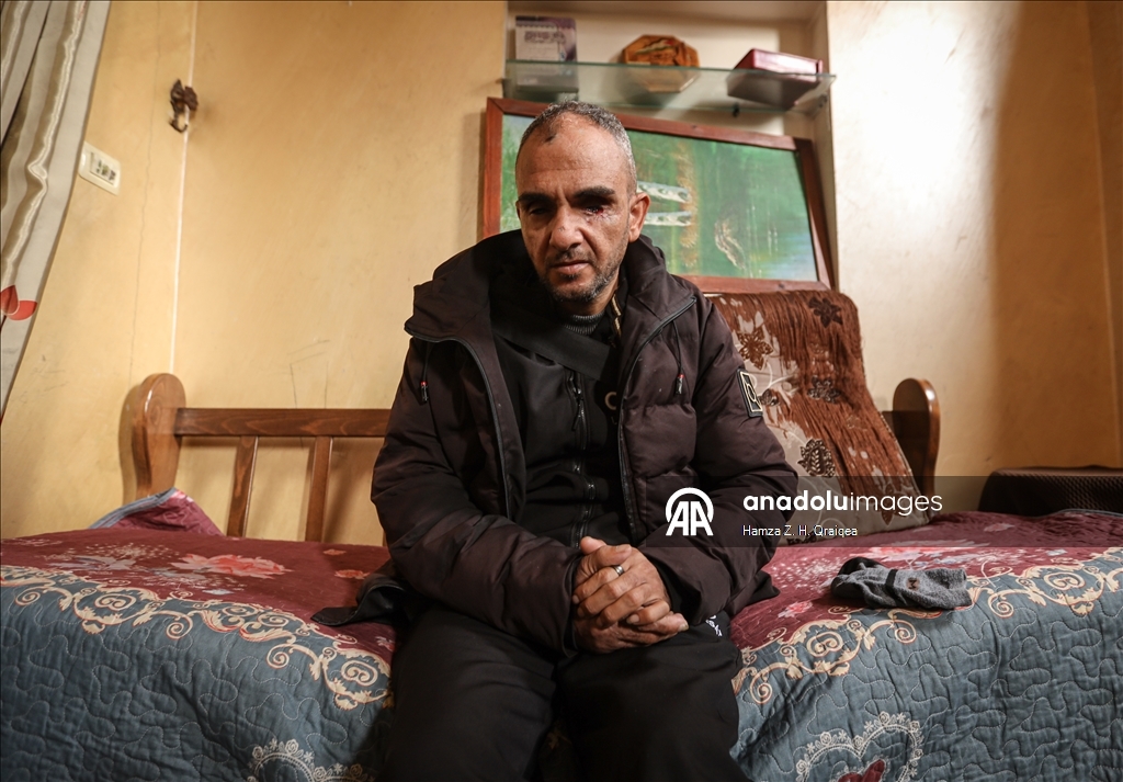 الفلسطيني أحمد.. مأساة فقد الابن وألوان الحياة بقصف إسرائيلي