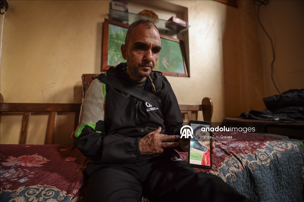 الفلسطيني أحمد.. مأساة فقد الابن وألوان الحياة بقصف إسرائيلي