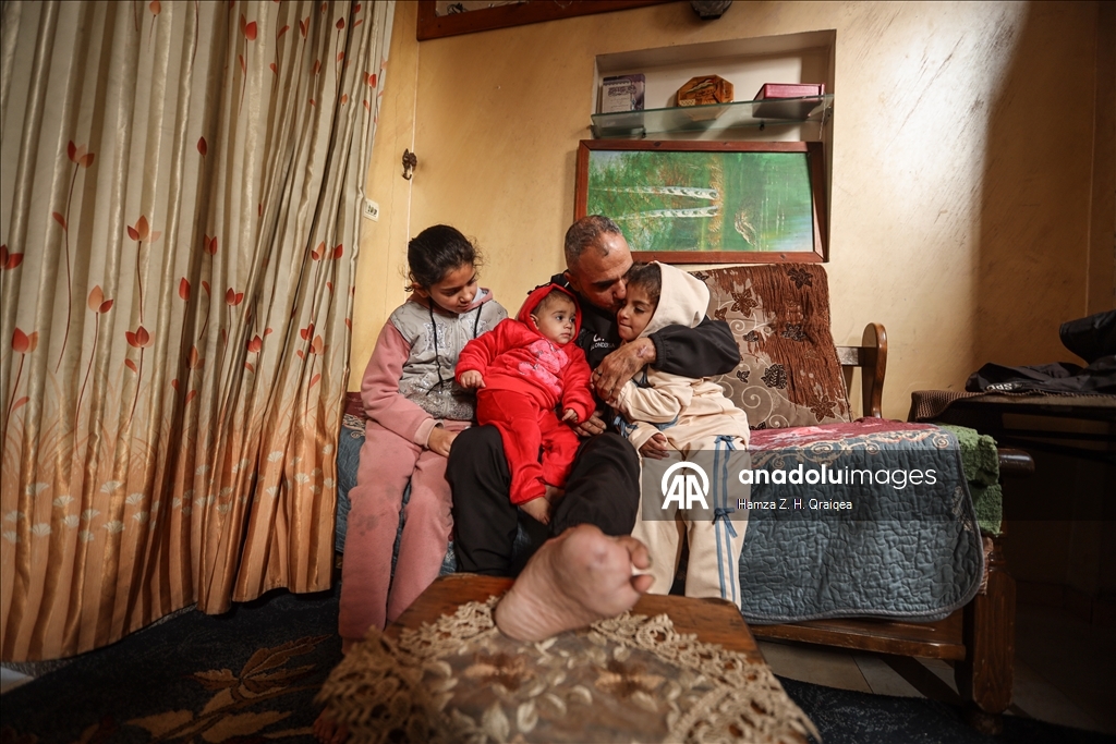 الفلسطيني أحمد.. مأساة فقد الابن وألوان الحياة بقصف إسرائيلي