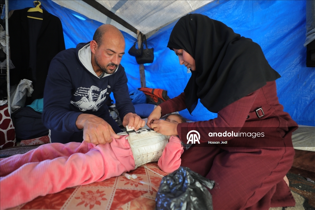 Парализованный в результате израильских атак ребенок из Газы ждет лечения