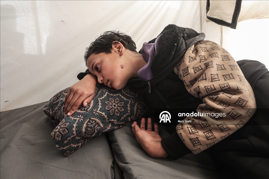 الطفل صهيب بغزة.. خرج لجلب الطعام فعاد فاقداً الكلام