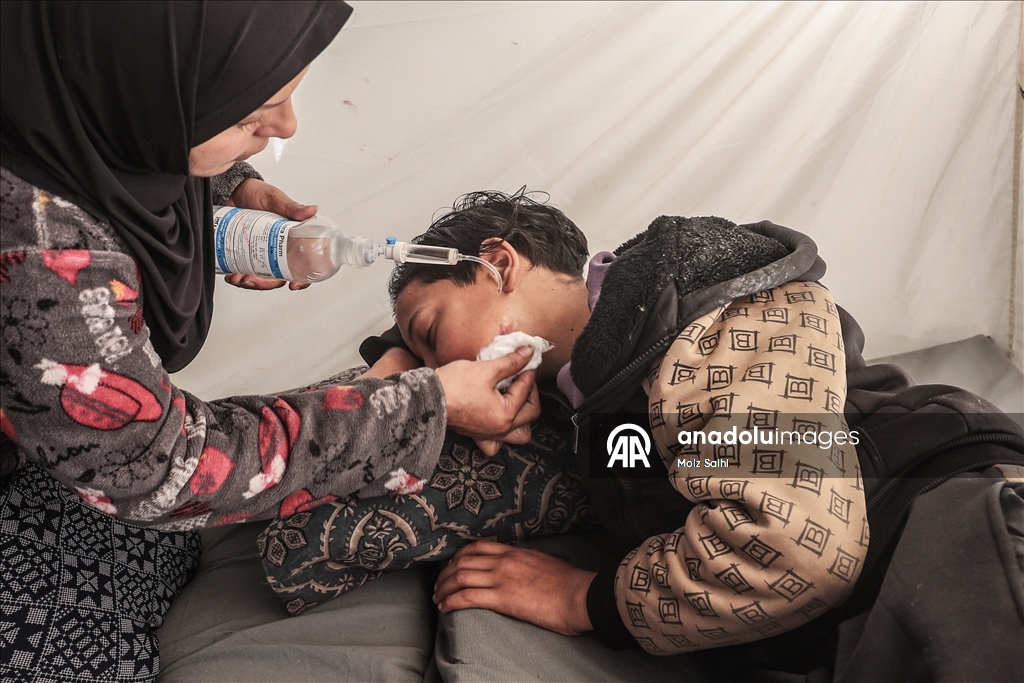 الطفل صهيب بغزة.. خرج لجلب الطعام فعاد فاقداً الكلام