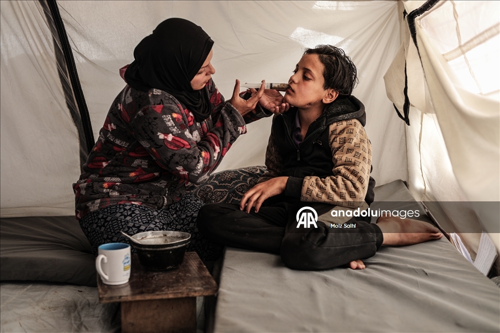 الطفل صهيب بغزة.. خرج لجلب الطعام فعاد فاقداً الكلام