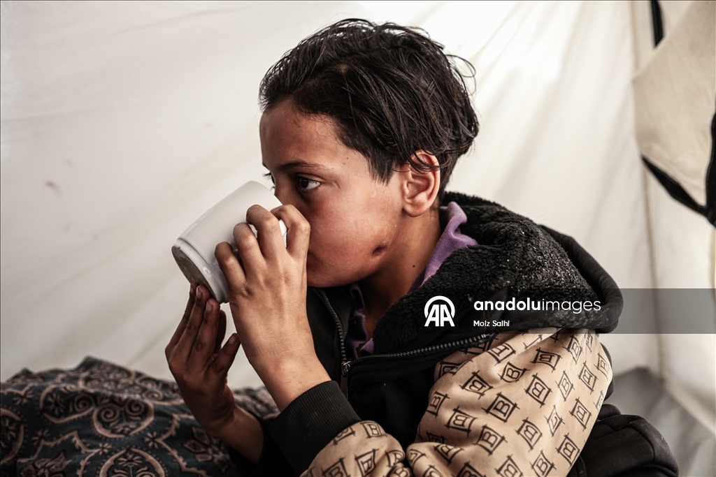 الطفل صهيب بغزة.. خرج لجلب الطعام فعاد فاقداً الكلام