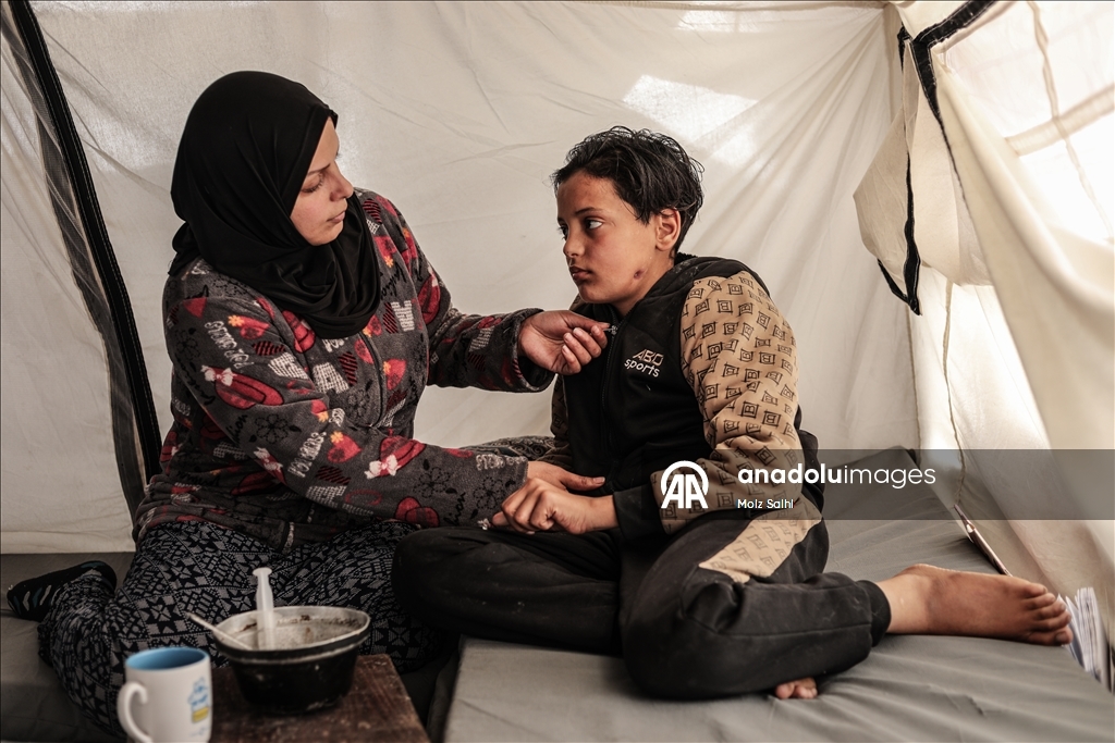 الطفل صهيب بغزة.. خرج لجلب الطعام فعاد فاقداً الكلام