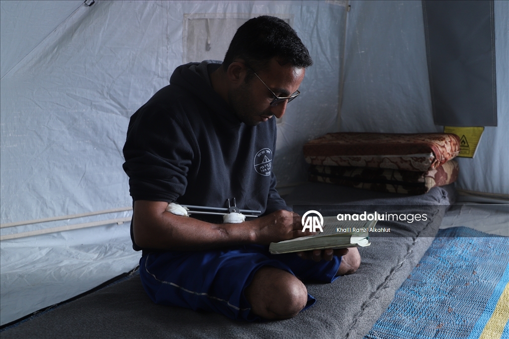 İsrail saldırısında iki bacağını kaybeden Filistinli Alluş, yaşam mücadelesi veriyor