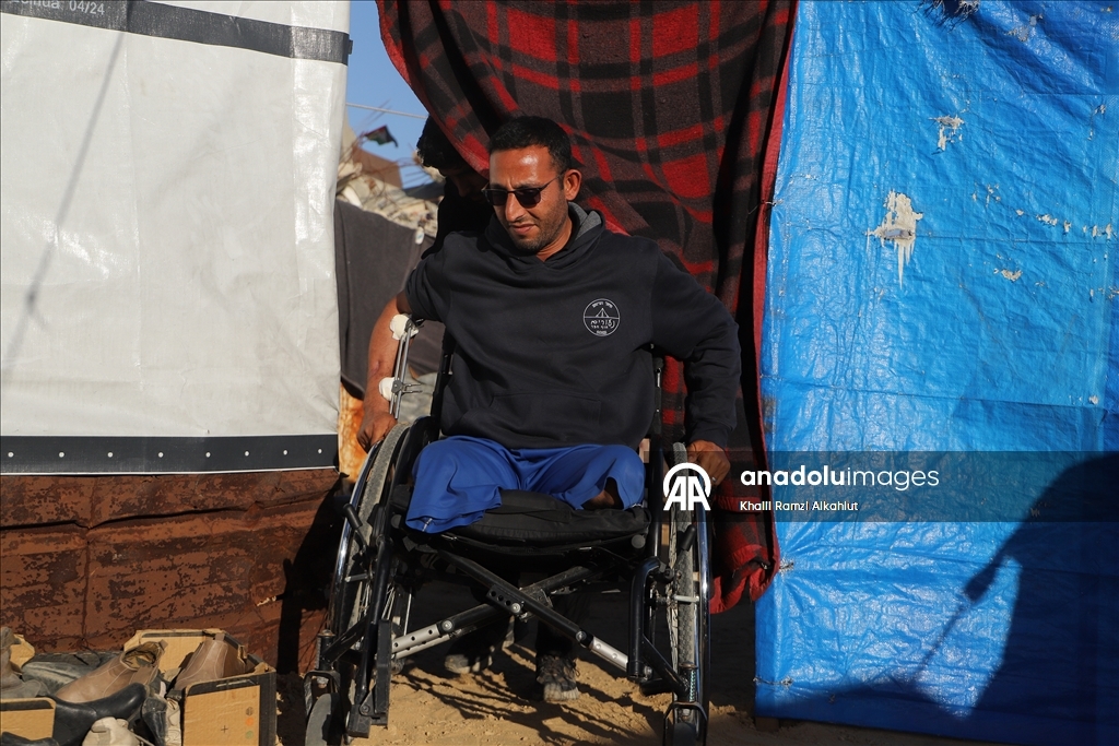 İsrail saldırısında iki bacağını kaybeden Filistinli Alluş, yaşam mücadelesi veriyor
