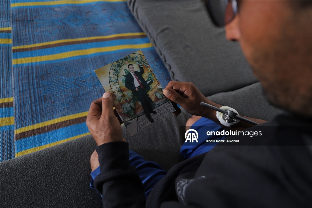 İsrail saldırısında iki bacağını kaybeden Filistinli Alluş, yaşam mücadelesi veriyor