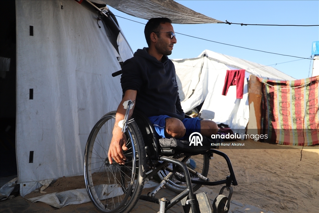 İsrail saldırısında iki bacağını kaybeden Filistinli Alluş, yaşam mücadelesi veriyor