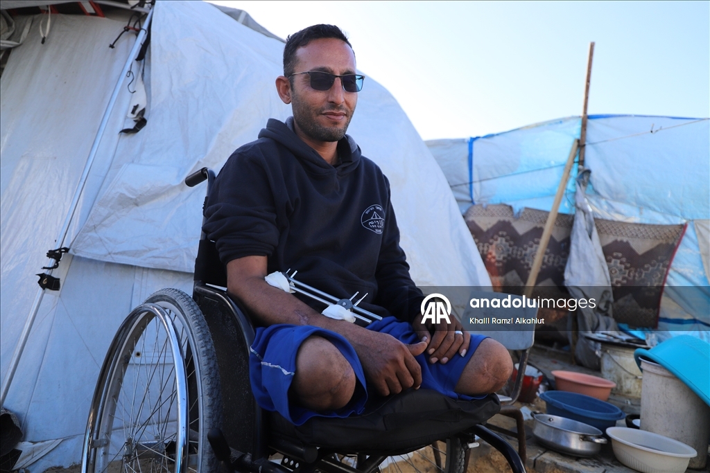 İsrail saldırısında iki bacağını kaybeden Filistinli Alluş, yaşam mücadelesi veriyor