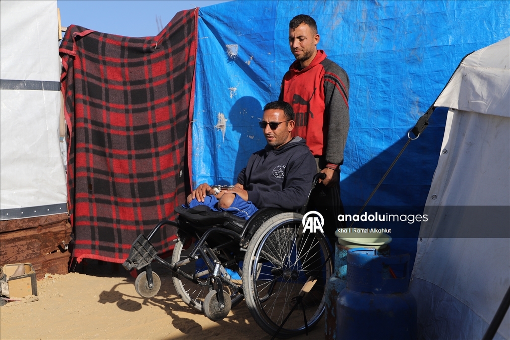 İsrail saldırısında iki bacağını kaybeden Filistinli Alluş, yaşam mücadelesi veriyor