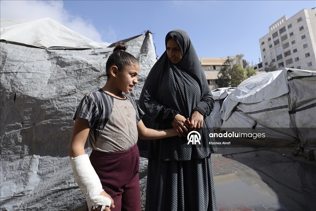 Тяжело раненная в результате израильских атак палестинская девочка испытывает трудности при ходьбе