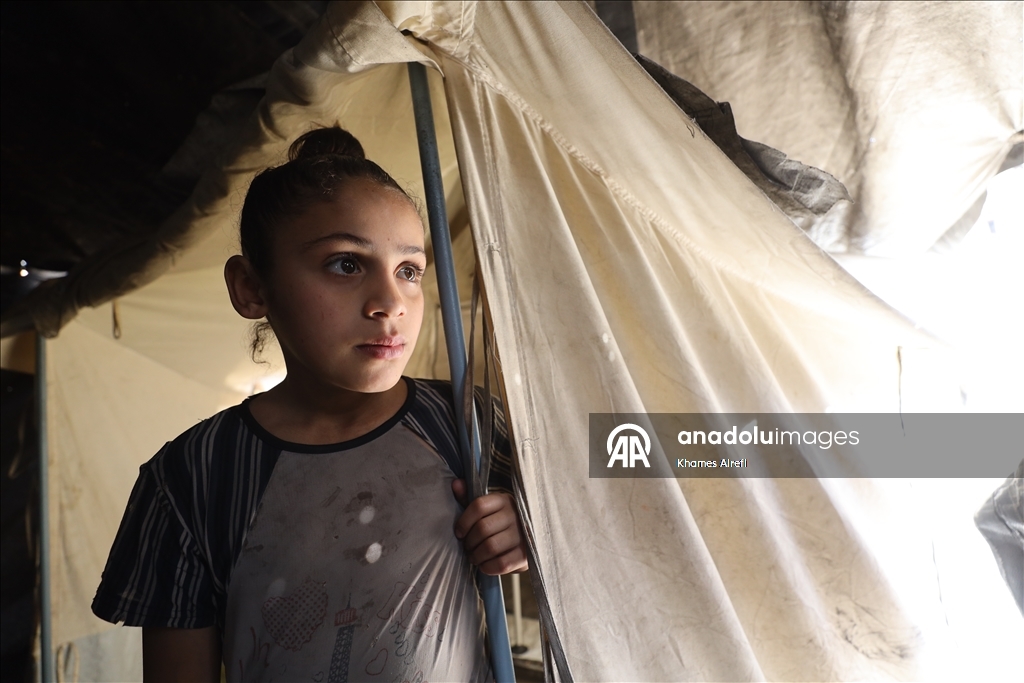 Тяжело раненная в результате израильских атак палестинская девочка испытывает трудности при ходьбе