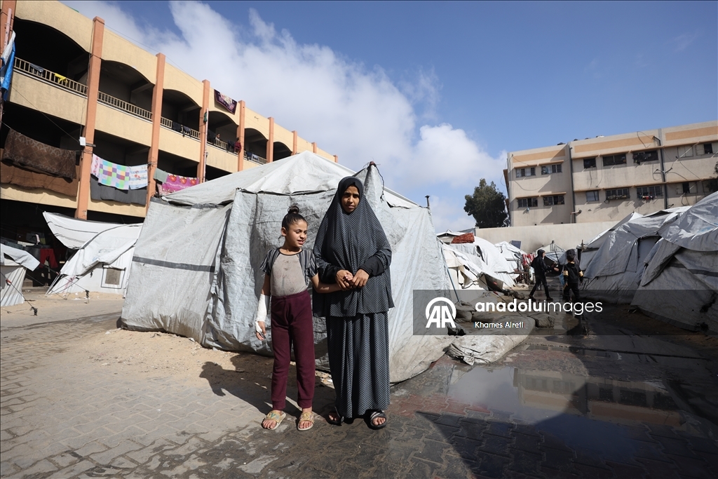 Тяжело раненная в результате израильских атак палестинская девочка испытывает трудности при ходьбе